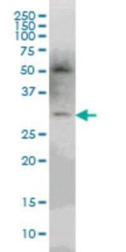 PLEKHO2 Antibody (3D9), Novus Biologicals 0.1 mg | Buy Online | Novus Biologicals | Fisher Scientific