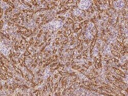 PLEKHO2 Antibody, Novus Biologicals 100 &mu;g; Unconjugated:Antibodies,