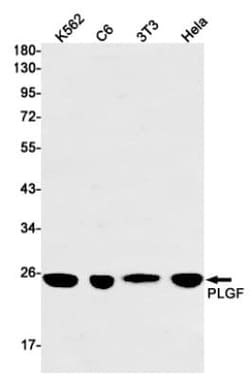 PLGF Antibody (S08-9C2), Novus Biologicals:Antibodies:Primary Antibodies