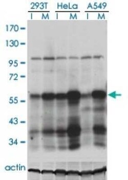 PLK1 Antibody (2G12), Novus Biologicals 0.1 mg | Buy Online | Novus Biologicals | Fisher Scientific