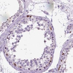 PLK4 Antibody, Novus Biologicals:Antibodies:Primary Antibodies