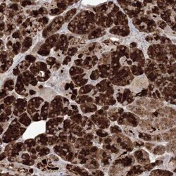 PLK5 Antibody, Novus Biologicals 25 &mu;L, Unconjugated:Antibodies, Polyclonal