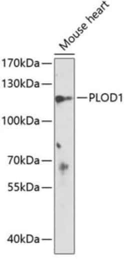 PLOD1 Antibody - BSA Free, Novus Biologicals:Antibodies:Primary Antibodies
