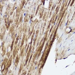 PLOD3 Antibody - BSA Free, Novus Biologicals 0.02 mL | Buy Online | Novus Biologicals | Fisher Scientific