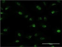 PLRG1 Antibody (7H2), Novus Biologicals 0.1 mg | Buy Online | Novus Biologicals | Fisher Scientific