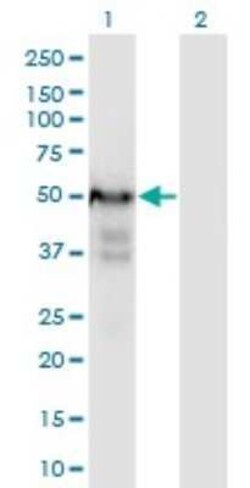 PLRG1 Antibody (7H2), Novus Biologicals 0.1 mg | Buy Online | Novus Biologicals | Fisher Scientific