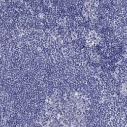 PLS1 Rabbit anti-Human, Polyclonal, Novus Biologicals 100 &mu;g; Unconjugated:Antibodies,