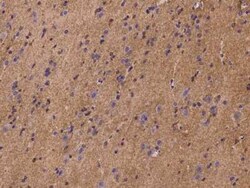 PLSCR4 Antibody, Novus Biologicals 50 &mu;g | Buy Online | Novus Biologicals | Fisher Scientific