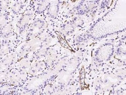 PLVAP Antibody, Novus Biologicals:Antibodies:Primary Antibodies