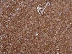 PMCA1 Antibody, Novus Biologicals 100 μg; Unconjugated:Antibodies, Polyclonal