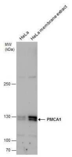 PMCA1 Antibody, Novus Biologicals 100 μg; Unconjugated:Antibodies, Polyclonal