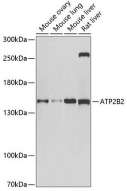 PMCA2 Antibody - Azide and BSA Free, Novus Biologicals:Antibodies:Primary