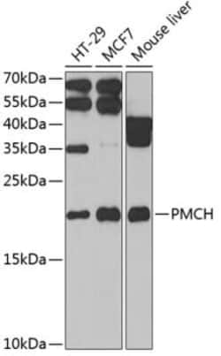 PMCH Antibody - BSA Free, Novus Biologicals 0.1 mL; Unconjugated:Antibodies,