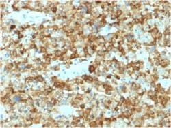 PMEL17/SILV Mouse anti-Human, Clone: PMEL/2037, Novus Biologicals:Antibodies:Primary