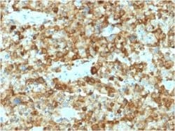 PMEL17/SILV Antibody (PMEL/2037) - Azide and BSA Free, Novus Biologicals