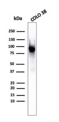 PMEL17/SILV Mouse anti-Human, Clone: PMEL/2037, Novus Biologicals:Antibodies:Primary
