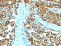PMEL17/SILV Antibody (PMEL/2038) - Azide and BSA Free, Novus Biologicals 100 &mu;g | Buy Online | Novus Biologicals | Fisher Scientific
