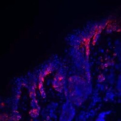 PMEL17/SILV Antibody (HMB45), Novus Biologicals 0.1mg; Unlabeled:Antibodies,