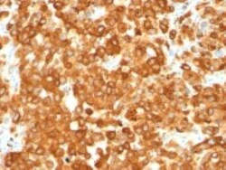 PMEL17/SILV Antibody (HMB45), Novus Biologicals 0.1mg; Unlabeled:Antibodies,
