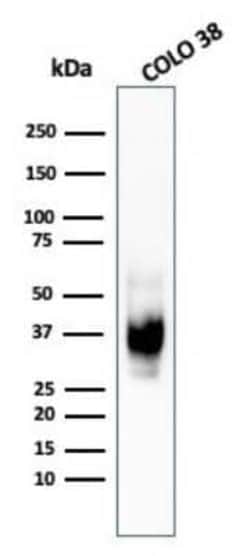 PMEL17/SILV Antibody (HMB45), Novus Biologicals 0.1mg; Unlabeled:Antibodies,