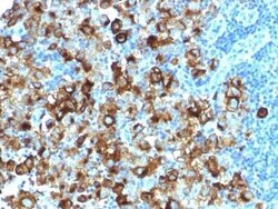 PMEL17/SILV Antibody (PMEL/1825R), Novus Biologicals:Antibodies:Primary