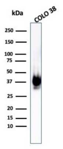 PMEL17/SILV Antibody (PMEL/1825R), Novus Biologicals:Antibodies:Primary