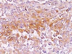 Novus Biologicals PMEL17/SILV Antibody (SPM286) - Azide and BSA Free, Novus