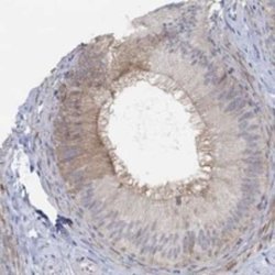 PMFBP1 Rabbit anti-Human, Polyclonal, Novus Biologicals 25 &mu;g | Buy Online | Novus Biologicals | Fisher Scientific