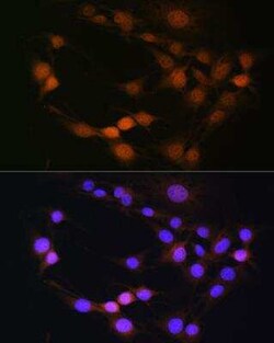 PML Protein Antibody - BSA Free, Novus Biologicals 0.02 mL, Unconjugated:Antibodies,