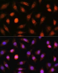 PML Protein Antibody - BSA Free, Novus Biologicals 0.02 mL, Unconjugated:Antibodies,