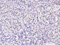 PML Protein Antibody, Novus Biologicals 50 &mu;g, Unconjugated:Antibodies,