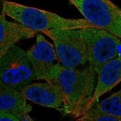 PMM1/Phosphomannomutase 1 Rabbit anti-Human, Polyclonal, Novus Biologicals