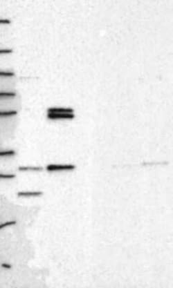 PMM1/Phosphomannomutase 1 Rabbit anti-Human, Polyclonal, Novus Biologicals