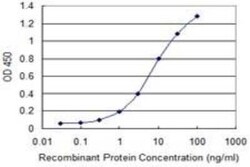 PMM2/Phosphomannomutase 2 Antibody (2E9), Novus Biologicals 0.1 mg | Buy Online | Novus Biologicals | Fisher Scientific
