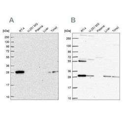 PMM2/Phosphomannomutase 2 Antibody, Novus Biologicals 25 &mu;L; Unconjugated:Antibodies,