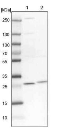 PMM2/Phosphomannomutase 2 Antibody, Novus Biologicals 25 &mu;L; Unconjugated:Antibodies,