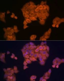 PMP70 Rabbit anti-Human, Mouse, Rat, Clone: 3V4K3, Novus Biologicals 100