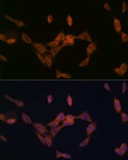 PMP70 Rabbit anti-Human, Mouse, Rat, Clone: 3V4K3, Novus Biologicals 100