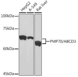 PMP70 Rabbit anti-Human, Mouse, Rat, Clone: 3V4K3, Novus Biologicals 100