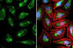 PMP70 Antibody, Novus Biologicals 100 &mu;g | Buy Online | Novus Biologicals | Fisher Scientific