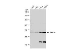 PMP70 Antibody, Novus Biologicals 100 &mu;g | Buy Online | Novus Biologicals | Fisher Scientific