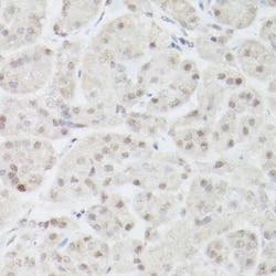 PMS2 Rabbit anti-Human, Clone: 4E5F1, Novus Biologicals:Antibodies:Primary