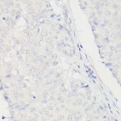 PMS2 Rabbit anti-Human, Clone: 4E5F1, Novus Biologicals:Antibodies:Primary