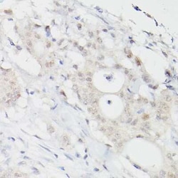 PMS2 Rabbit anti-Human, Clone: 4E5F1, Novus Biologicals:Antibodies:Primary