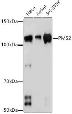 PMS2 Rabbit anti-Human, Clone: 4E5F1, Novus Biologicals:Antibodies:Primary