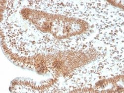 PMS2 Antibody (PMS2/4373R) - Azide and BSA Free, Novus Biologicals 100