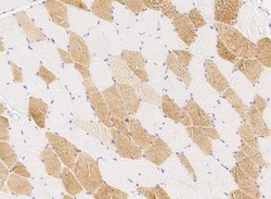 PMVK/phosphomevalonate kinase Rabbit anti-Human, Clone: 3, Novus Biologicals:Antibodies:Primary
