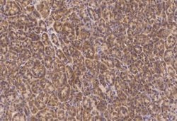 PMVK/phosphomevalonate kinase Rabbit anti-Human, Clone: 3, Novus Biologicals:Antibodies:Primary