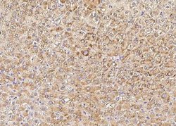PMVK/phosphomevalonate kinase Rabbit anti-Human, Clone: 3, Novus Biologicals:Antibodies:Primary