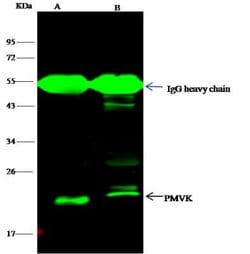 PMVK/phosphomevalonate kinase Rabbit anti-Human, Clone: 14, Novus Biologicals